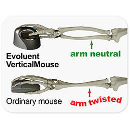 Mouse Evoluent VM4S, 6 butoane, USB, Mov